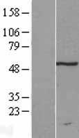 TRM11 (TRMT11) Human Over-expression Lysates NM_001031712