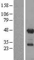 APOBEC3G Human Over-expression Lysates NM_021822