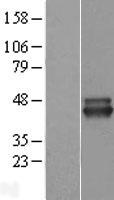 ALS2CR1 (NIF3L1) Human Over-expression Lysates NM_001142355