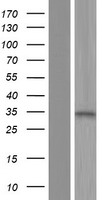 ALS2CR1 (NIF3L1) Human Over-expression Lysates NM_001142356