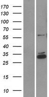 CCDC90B Human Over-expression Lysates NM_021825