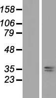 ls060496 aasdhppt human over expression lysates nm 015423 wb testing 1