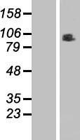 RINT1 Human Over-expression Lysates NM_021930