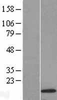 SCOC Human Over-expression Lysates NM_032547