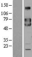 ls060681 fkbp10 human over expression lysates nm 021939 wb testing 1