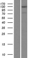 ls060684 trappc11 human over expression lysates nm 021942 wb testing 1