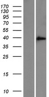 ZFAND3 Human Over-expression Lysates NM_021943