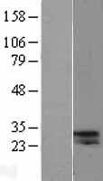 ls063036 cela2a human over expression lysates nm 033440 wb testing 1