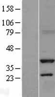 Serine racemase (SRR) Human Over-expression Lysates NM_021947
