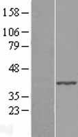 ls063874 abhd4 human over expression lysates nm 022060 wb testing 1