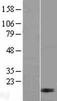 MRPL17 Human Over-expression Lysates NM_022061