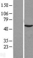 C14orf133 (VIPAS39) Human Over-expression Lysates NM_022067