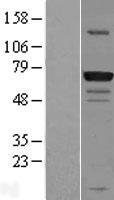 GPATCH3 Human Over-expression Lysates NM_022078
