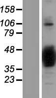 SNAP-beta (NAPB) Human Over-expression Lysates NM_022080