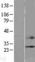 CIDE C (CIDEC) Human Over-expression Lysates NM_022094
