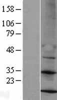 MRPS14 Human Over-expression Lysates NM_022100