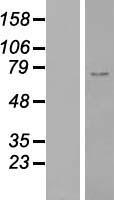ZNF667 Human Over-expression Lysates NM_022103