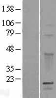 GPSM3 Human Over-expression Lysates NM_022107