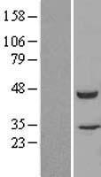 FKBPL Human Over-expression Lysates NM_022110