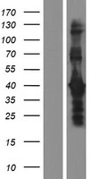 DMRTB1 Human Over-expression Lysates NM_033067
