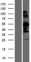 DMRTA1 Human Over-expression Lysates NM_022160