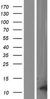p53 AIP1 (TP53AIP1) Human Over-expression Lysates NM_022112