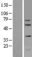 FIGNL1 Human Over-expression Lysates NM_001042762