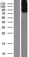 DENTT (TSPYL2) Human Over-expression Lysates NM_022117
