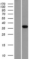 PRSS22 Human Over-expression Lysates NM_022119