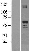 OXCT2 Human Over-expression Lysates NM_022120