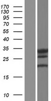 LHPP Human Over-expression Lysates NM_001167880