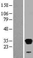 LHPP Human Over-expression Lysates NM_022126