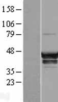 SNX16 Human Over-expression Lysates NM_022133