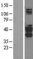 SNX16 Human Over-expression Lysates NM_152836