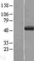 SMOC1 Human Over-expression Lysates NM_001034852