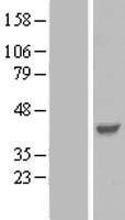 Parvin gamma (PARVG) Human Over-expression Lysates NM_001137606