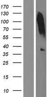ls064102 tenomodulin tnmd human over expression lysates nm 022144 wb testing 1