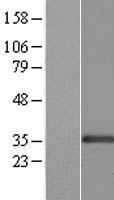ls064105 fksg14 cenpk human over expression lysates nm 022145 wb testing 1