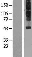 NPFF1 Receptor (NPFFR1) Human Over-expression Lysates NM_022146