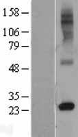 RTP4 Human Over-expression Lysates NM_022147