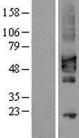 CRLF2 Human Over-expression Lysates NM_022148