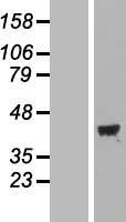 MAP1 (MOAP1) Human Over-expression Lysates NM_022151