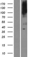 BIGM103 (SLC39A8) Human Over-expression Lysates NM_022154