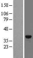 FN3K Human Over-expression Lysates NM_022158