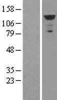 MDA5 (IFIH1) Human Over-expression Lysates NM_022168