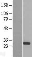 PDF Human Over-expression Lysates NM_022341