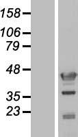 C17orf75 Human Over-expression Lysates NM_022344
