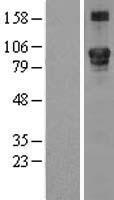 LEPRE1 (P3H1) Human Over-expression Lysates NM_022356