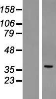 POPDC3 Human Over-expression Lysates NM_022361