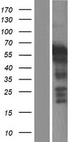 LHX5 Human Over-expression Lysates NM_022363